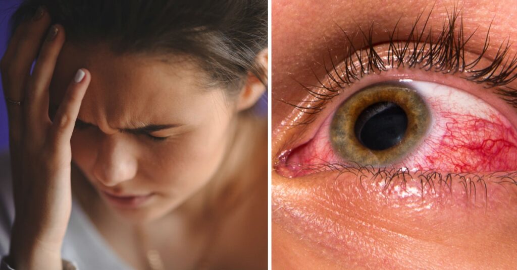 sintomas-y-causas-del-glaucoma