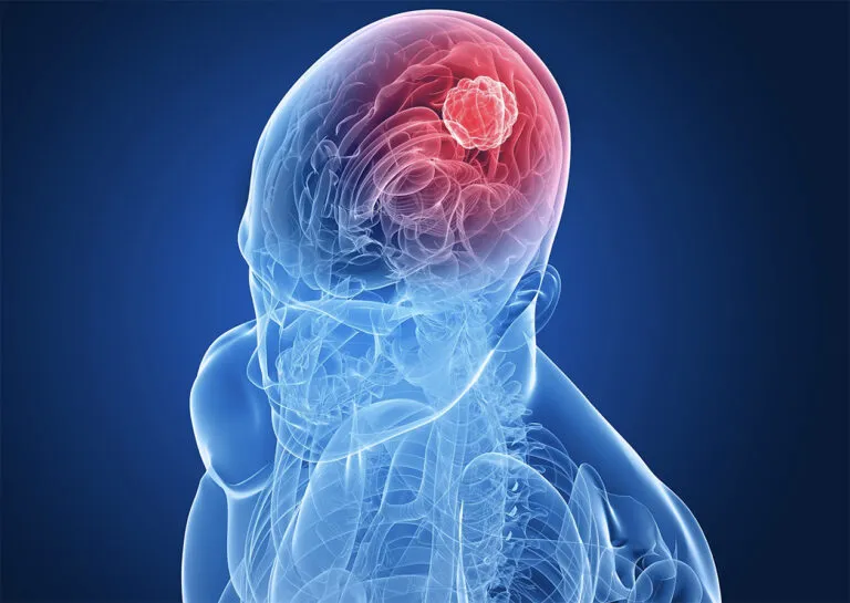 cbd-beneficios-sistema-nervioso