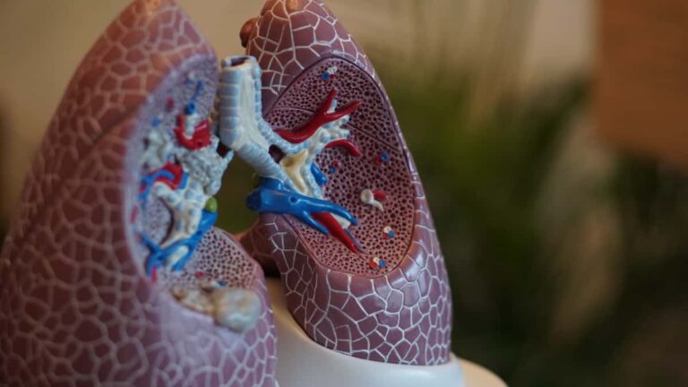 pulmones